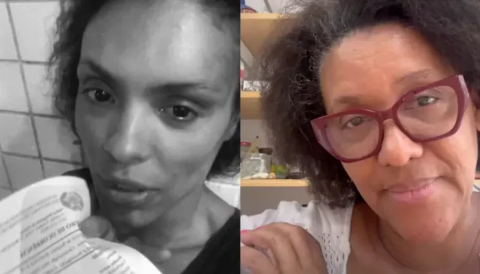 Lidi Lisboa fica ferida no rosto após reagir a assalto e mãe faz apelo: 'Faça diferente' Foto: Reprodução/Instagram / Contigo