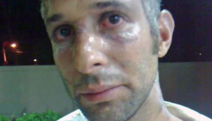 24agressao1