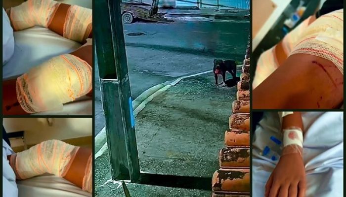 Samuel brincava com amigos quando foi surpreendido por animal solto; ferimentos graves na coxa exigiram cirurgia de emergência e comovem a cidade