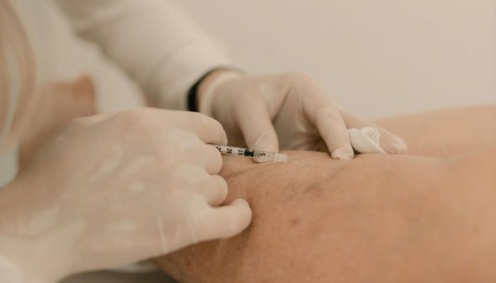 municipio-inaugura-clinica-vascular-municipal-para-cirurgias-e-exames-clinica-vai-oferecer-consultas-de-cirurgia-vascular-e-angiologia-exames-tratamento-de-varizes
